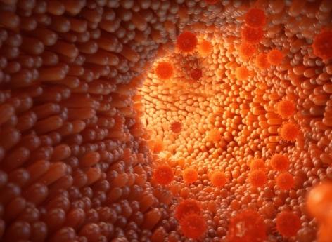 Cancer colorectal : un profil du microbiote intestinal très évocateur