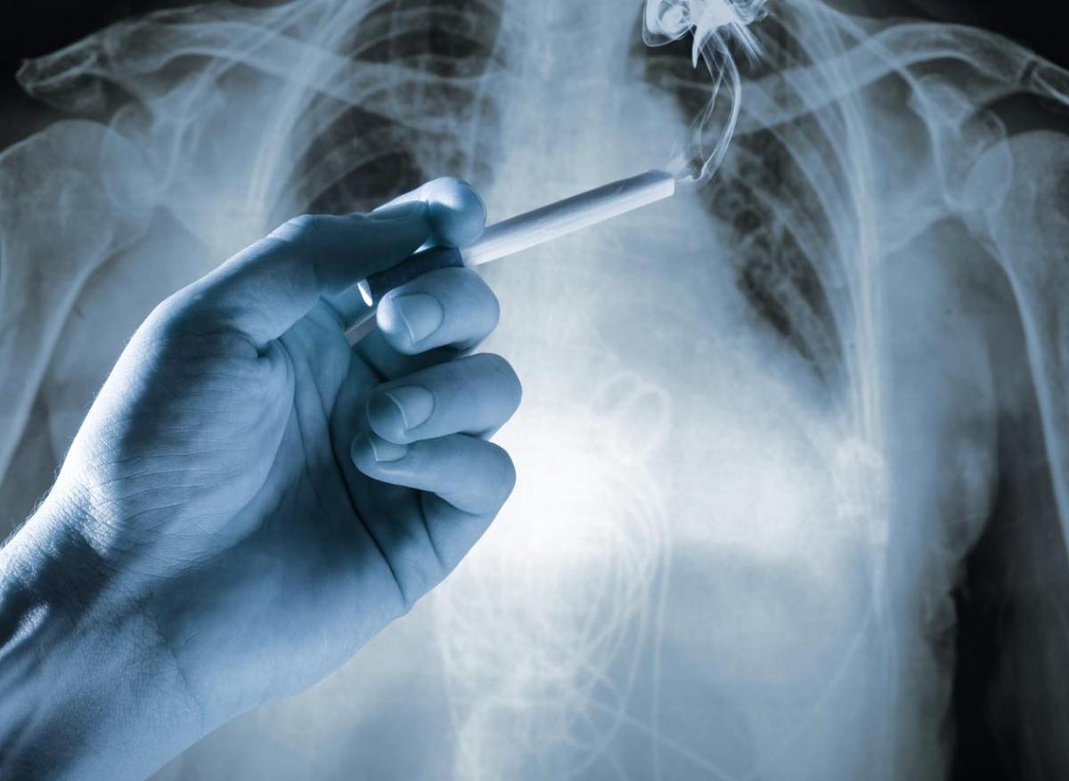 Cancer du poumon : les États-Unis avancent le dépistage des personnes à risque à 50 ans