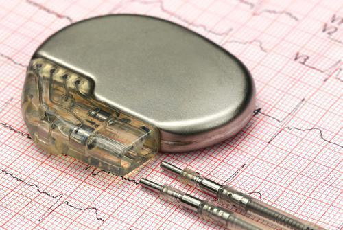 Pacemakers : des mises à jour pour éviter le piratage