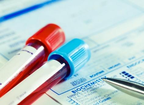 Fibromyalgie : un équipe aurait mis au point un test sanguin