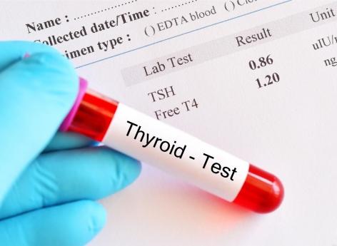 Cancer de la thyroïde : un nouveau test plus précis