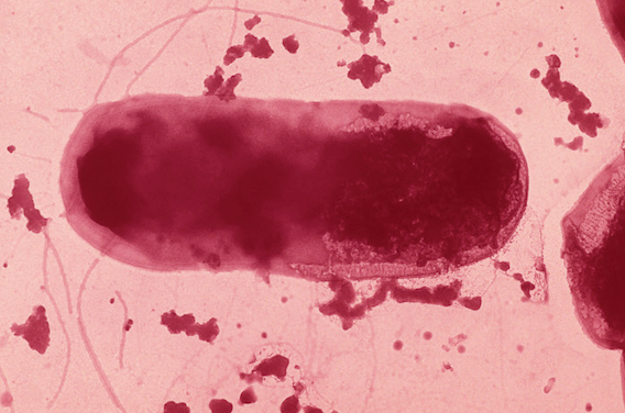 Maladie de Crohn : cibler une enzyme sécrétée par une E. coli type AEIC