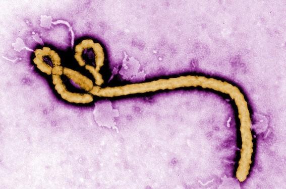 Ebola : le virus peut persister plus d'un an dans le sperme