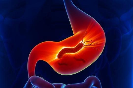 Cancer gastrique : le traitement d'Helicobacter pylori diminue le risque de récidive 