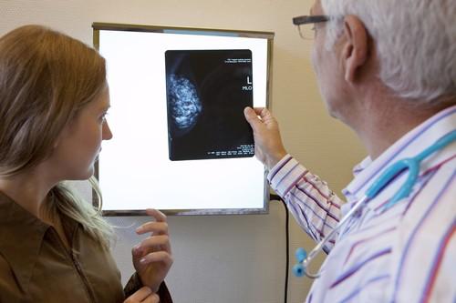 Cancer du sein : chute de la mortalité en France