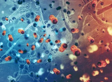 Cancer du côlon : un microbiote altéré peut favoriser son développement