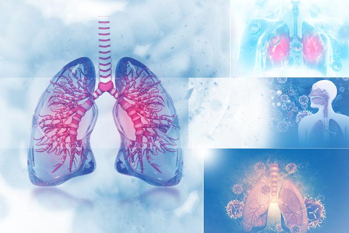 Cancer du poumon à petites cellules : échec de l'immunothérapie d'entretien