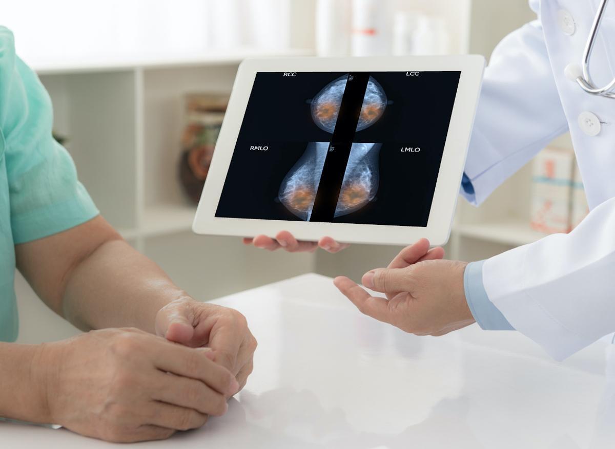 Insuffisance cardiaque : les mammographies pourraient la détecter