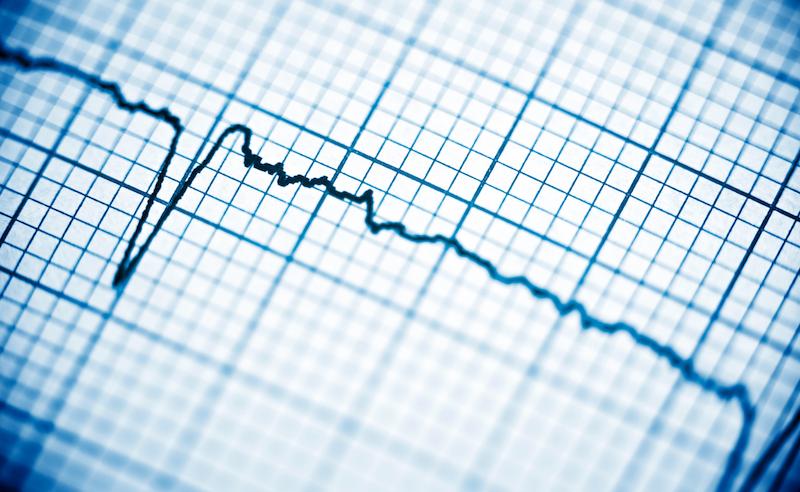 FA : l'ablation réduit mieux le risque de démence que les médicaments en cas d’athérosclérose associée