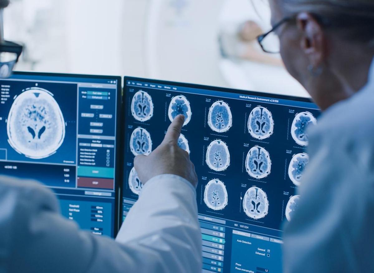 AVC : une intelligence artificielle accélère le diagnostic et le traitement