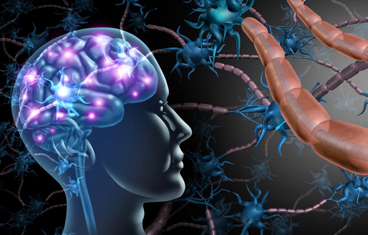 Sclérose en plaques et progression : vers une unification des concepts de phase inflammatoire et neurodégénérative