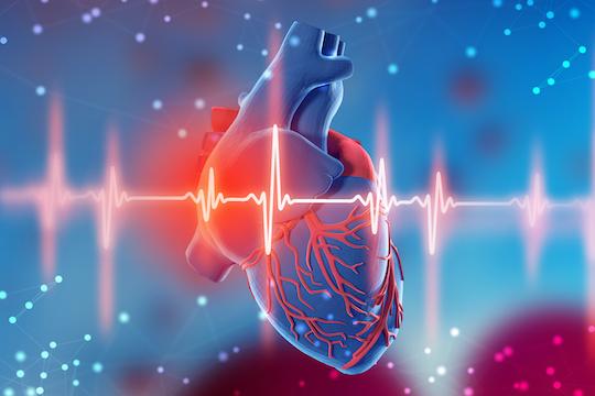 Thrombus mural : un mauvais pronostic malgré l’anticoagulation 