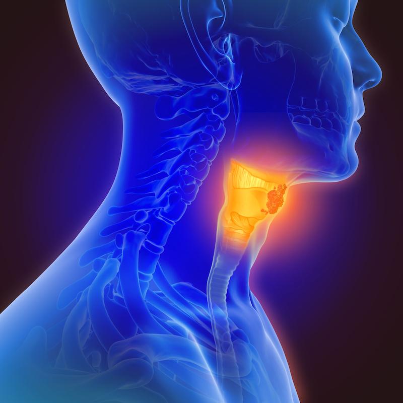 Adénocarcinome de l’œsophage :   Chimiothérapie par FLOT ou radiochimiothérapie par CROSS ? that is the question ! 