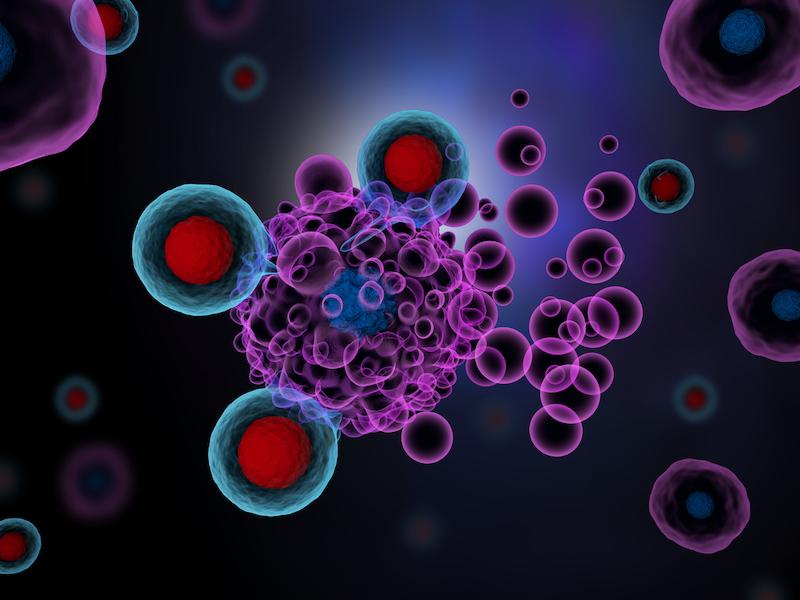 Cancers localisés MSI : place de l’immunothérapie néoadjuvante