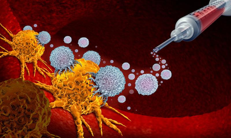 Carcinome épidermoïde de l'oesophage avancé : l'immunothérapie montre son efficacité en 2ème ligne