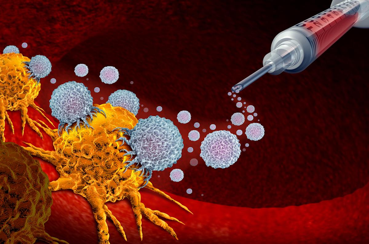 CBNPC non épidermoïde en 1ère ligne : l’association Platine-Alimta-Atezolizumab améliore la survie