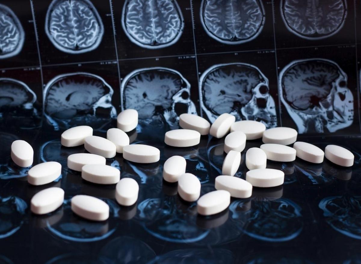 Alzheimer : les anticholinergiques associés à un risque accru