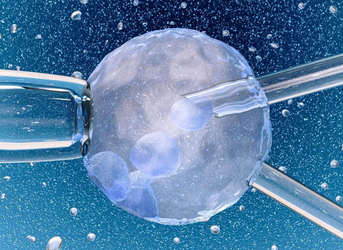 Cancers pédiatriques : plus élevés après transfert d'embryons congelés 
