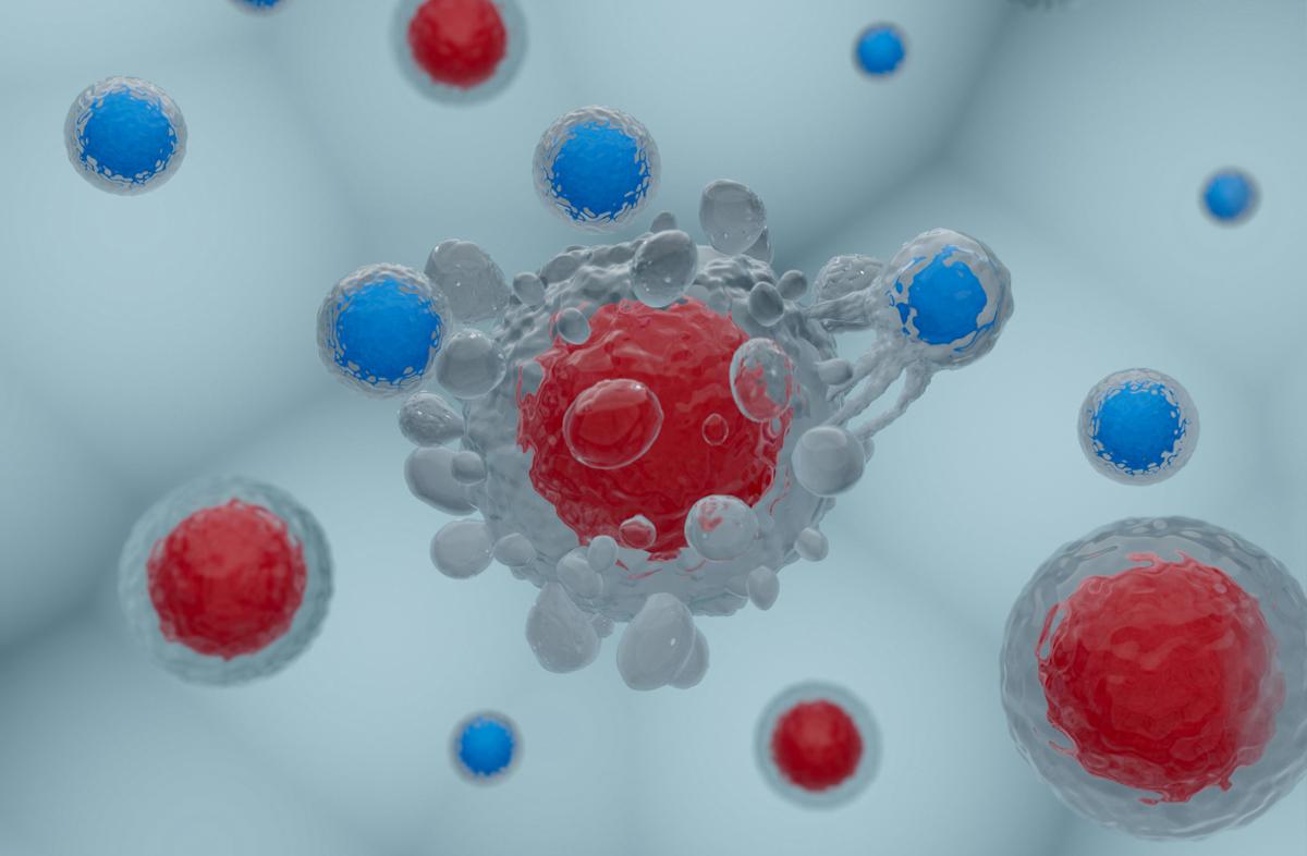 Myélome multiple réfractaire : un CAR-T cells plus efficace que les traitements de rattrapage standard