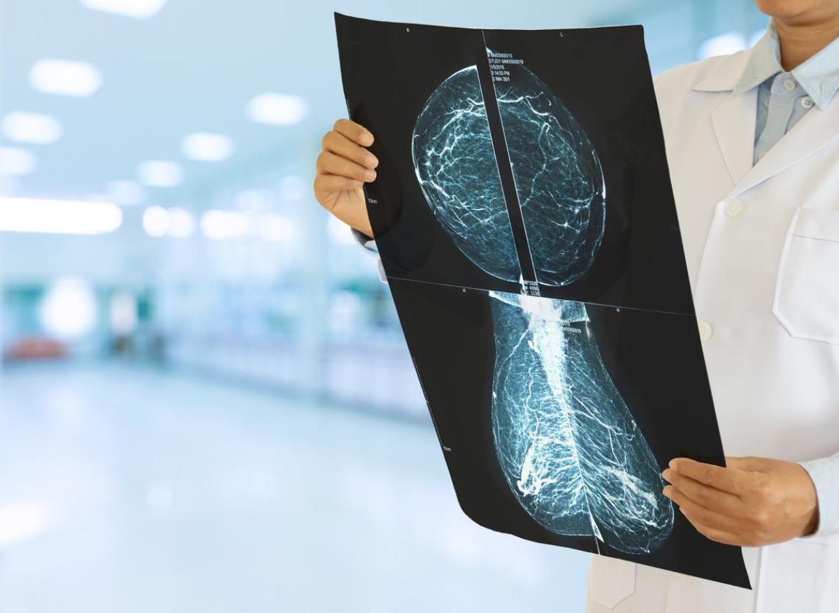 Cancer du sein : l'inflammation péri-tumorale favoriserait les métastases 