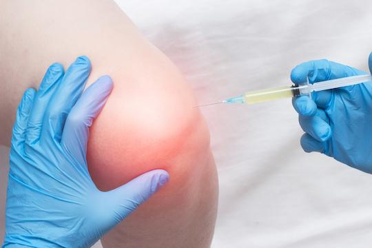 Gonarthrose : des injections augmentent l’épaisseur du cartilage chez l’homme