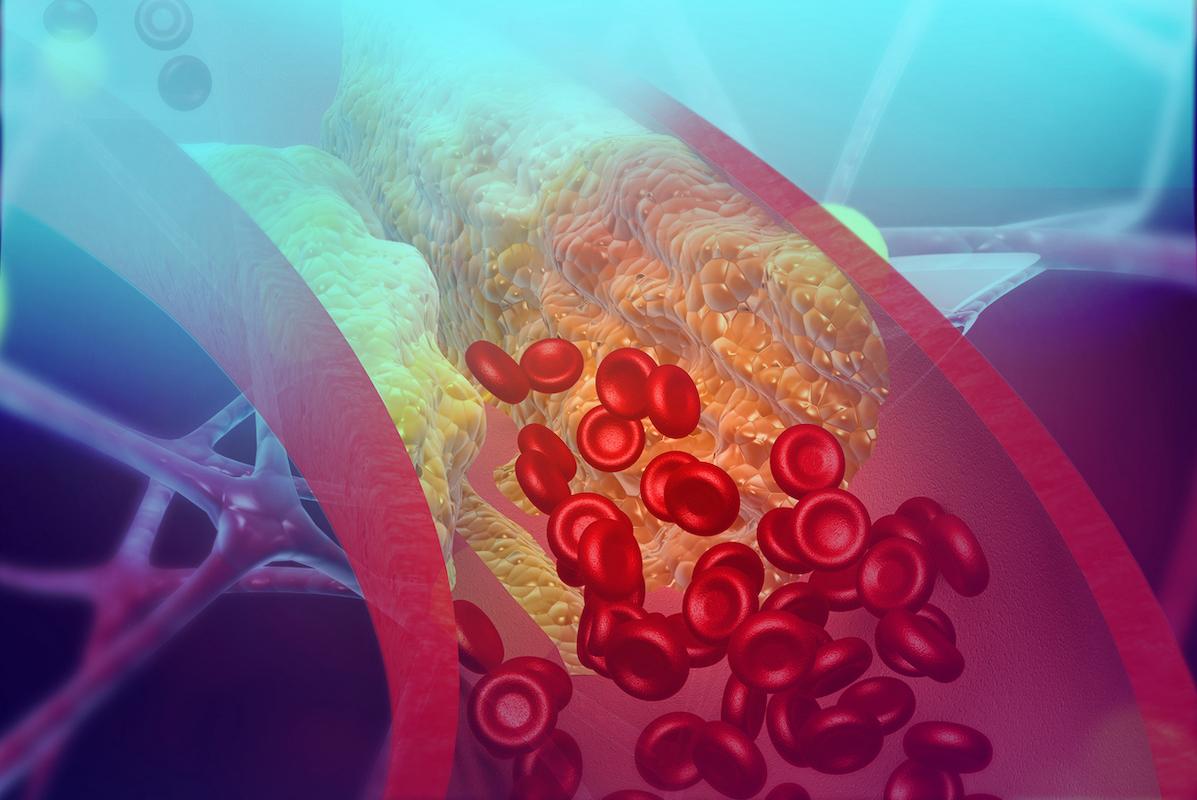 Risque cardiovasculaire et cholestérol : the lower pas forcément better