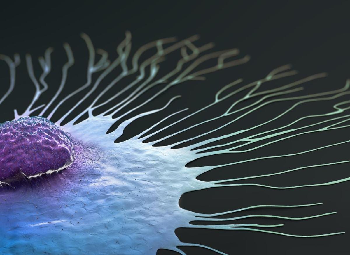 Métastases : on en sait plus sur la propagation des cellules du cancer du sein