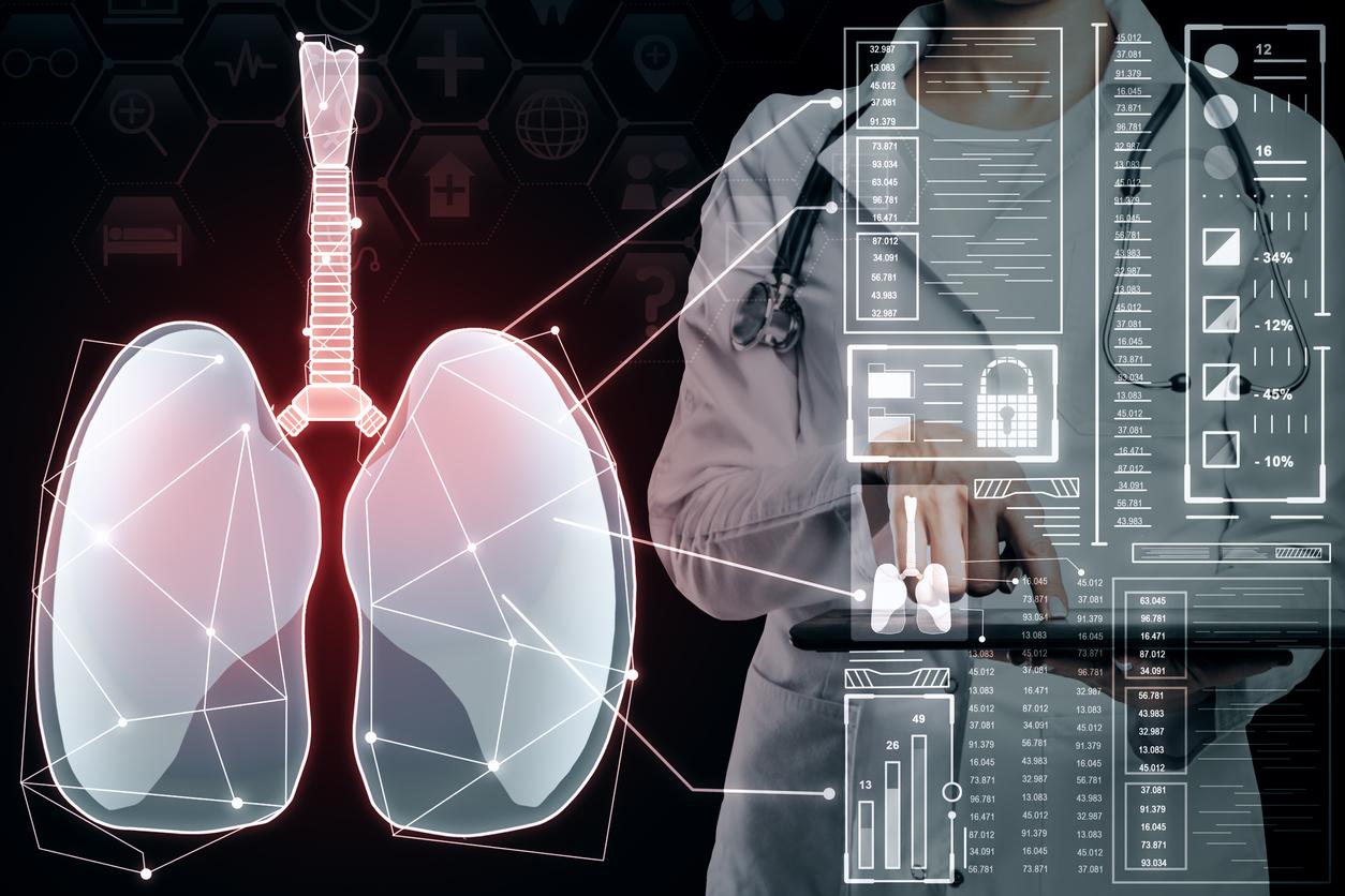 Intelligence artificielle : aussi bien que le radiologue pour la radio de poumons ?
