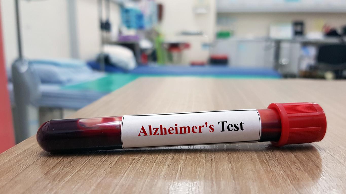 Le  Semaglutine essuie un échec dans la maladie d’Alzheimer. 