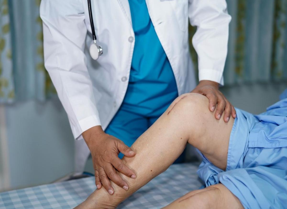 Arthrose du genou : l’ostéotomie tibiale reste une alternative à l’arthroplastie 