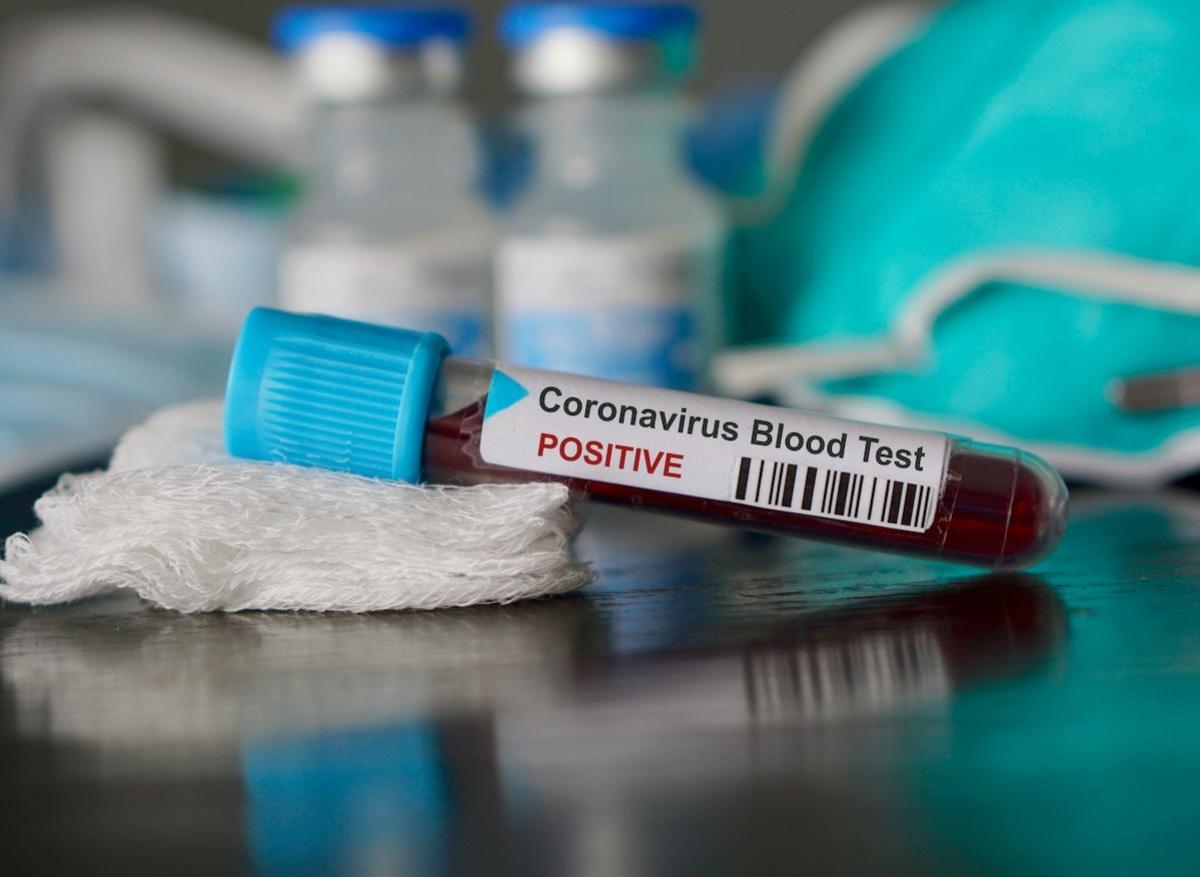 Coronavirus : première étude clinique avec l'hydroxychloroquine à Marseille