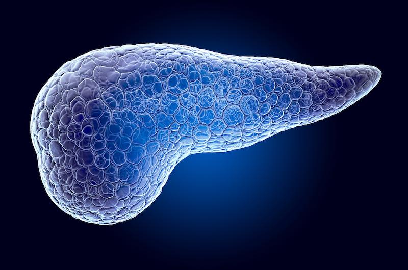 Adénocarcinome pancréatique localement avancé : quelle place du FOLFIRINOX modifié versus gemcitabine ?