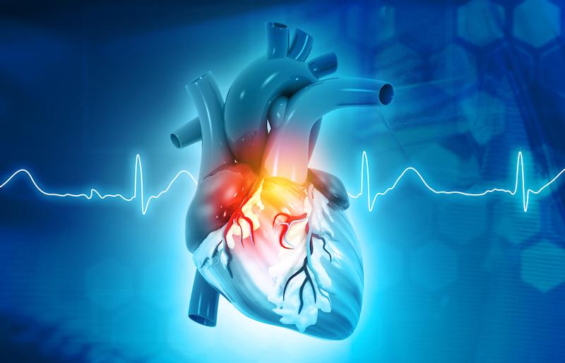 Impact cardiologique de l'immunothérapie : y penser et les monitorer davantage ?