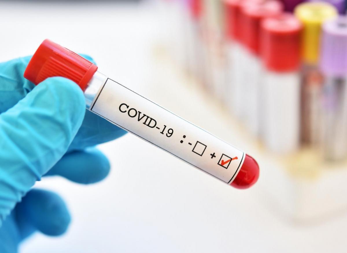 Covid-19 : une femme contagieuse et asymptomatique plus de 2 mois