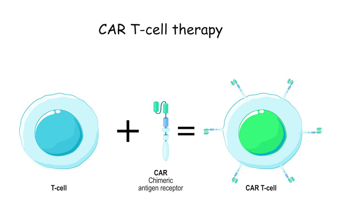 Leucémie lymphoblastique aiguë à cellules T incurable : l'édition de base ouvre la voie à un traitement révolutionnaire