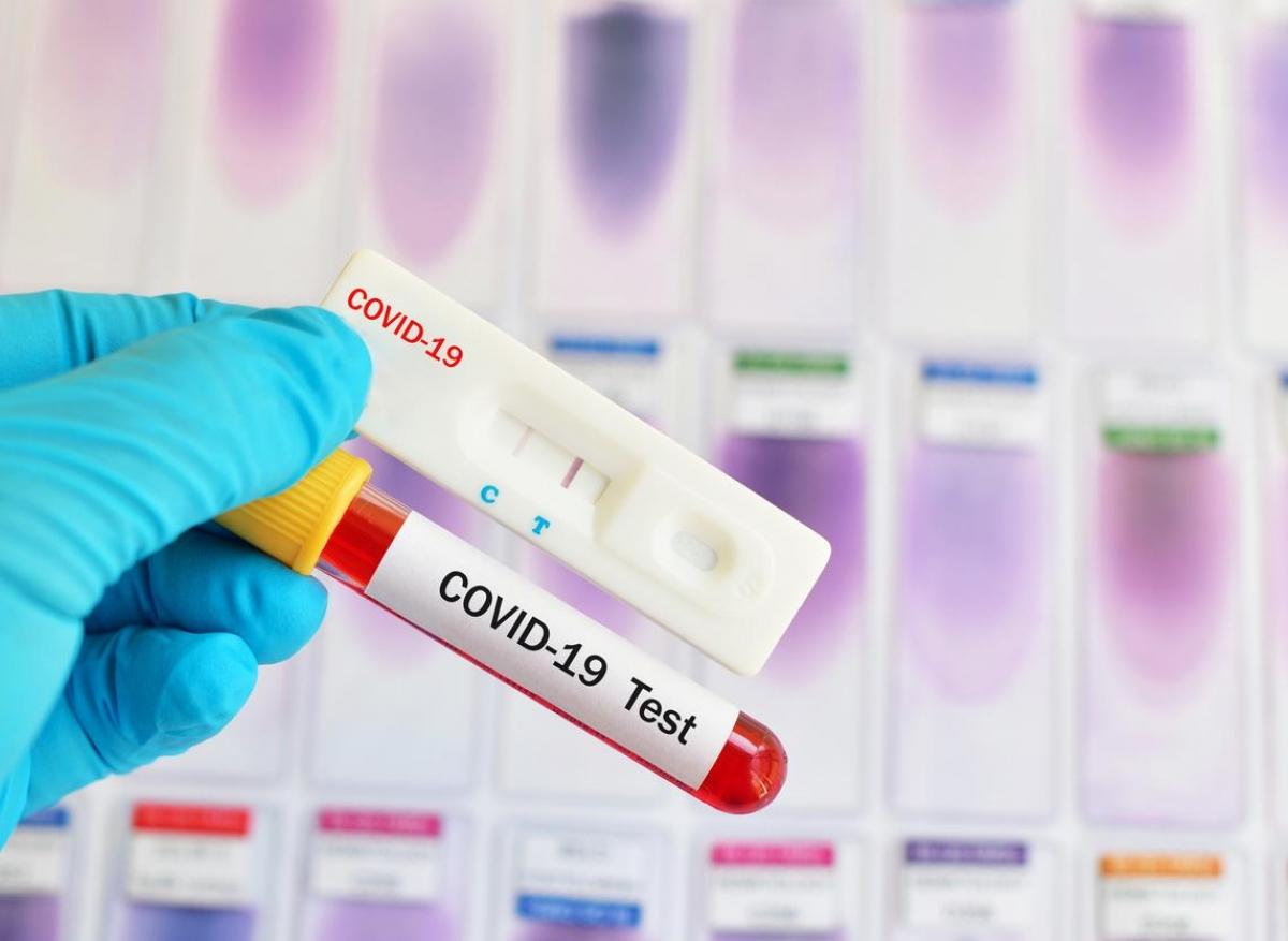 Coronavirus : on est loin des 700 000 tests par semaine promis par Edouard Philippe