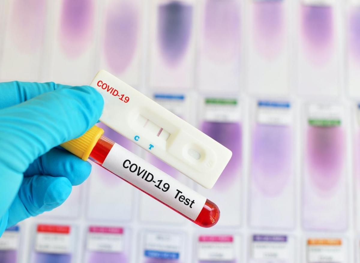 Covid-19 : réalisé trop tôt le test PCR-RT peut être négatif