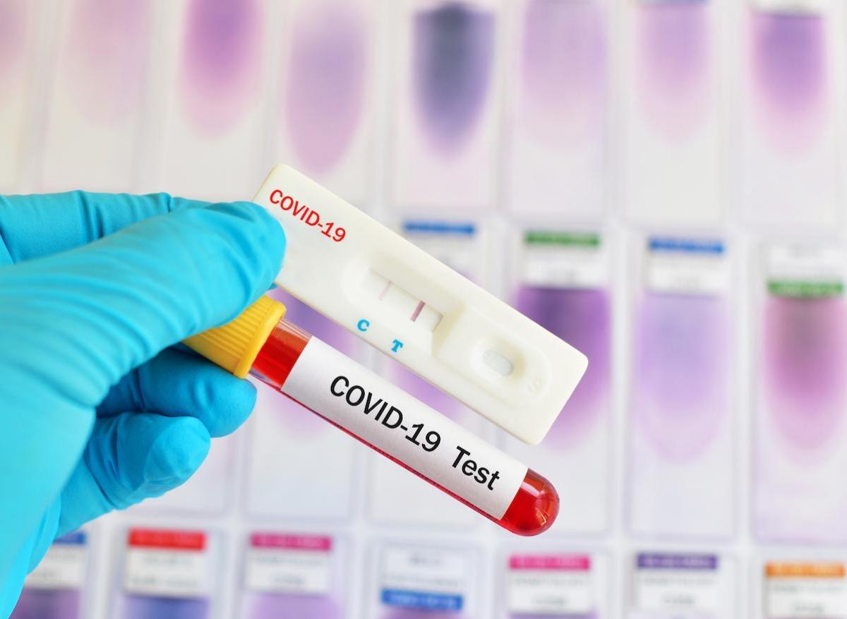 Covid-19 : le test antigénique est disponible 