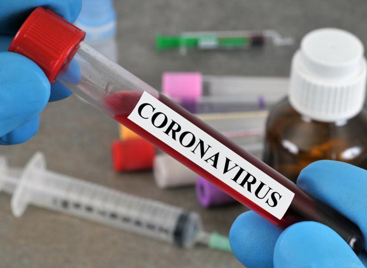 Covid-19 : un nouveau test sérologique bientôt disponible