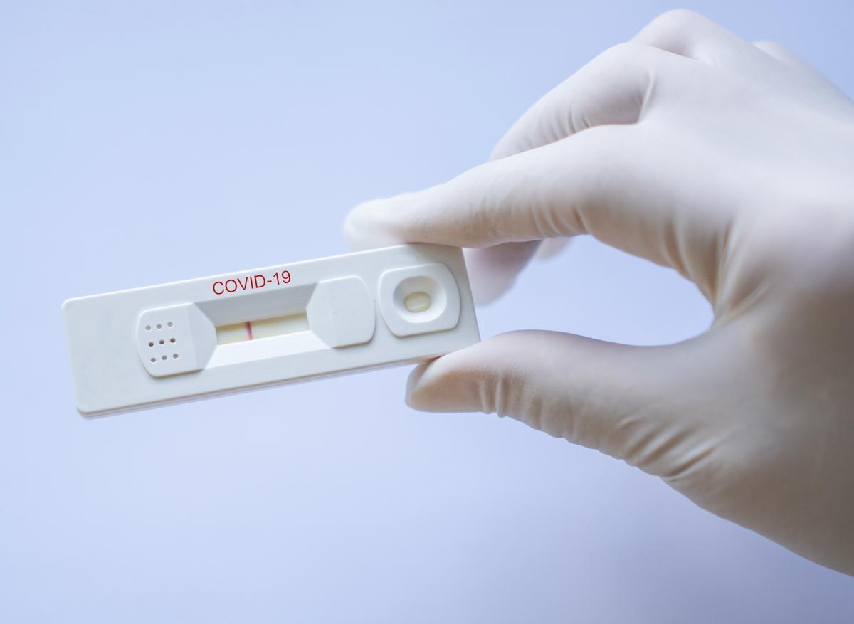 Covid-19 et autotests : validation par la Haute autorité de santé