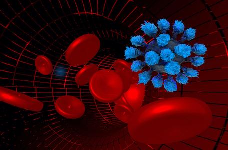 Covid-19 : probable bénéfice majeur des anticoagulants à la phase inflammatoire