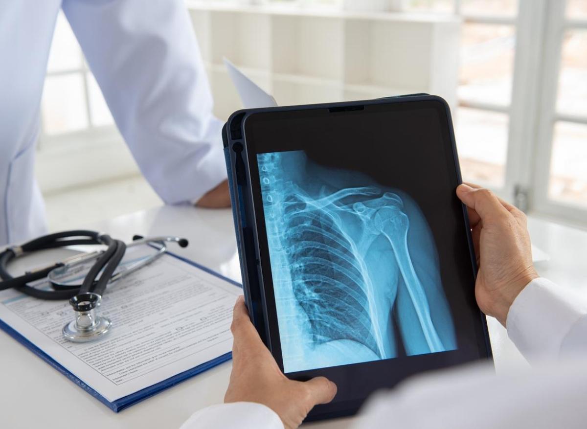 Ostéoporose : l’exposition aux PFAS pourrait y contribuer