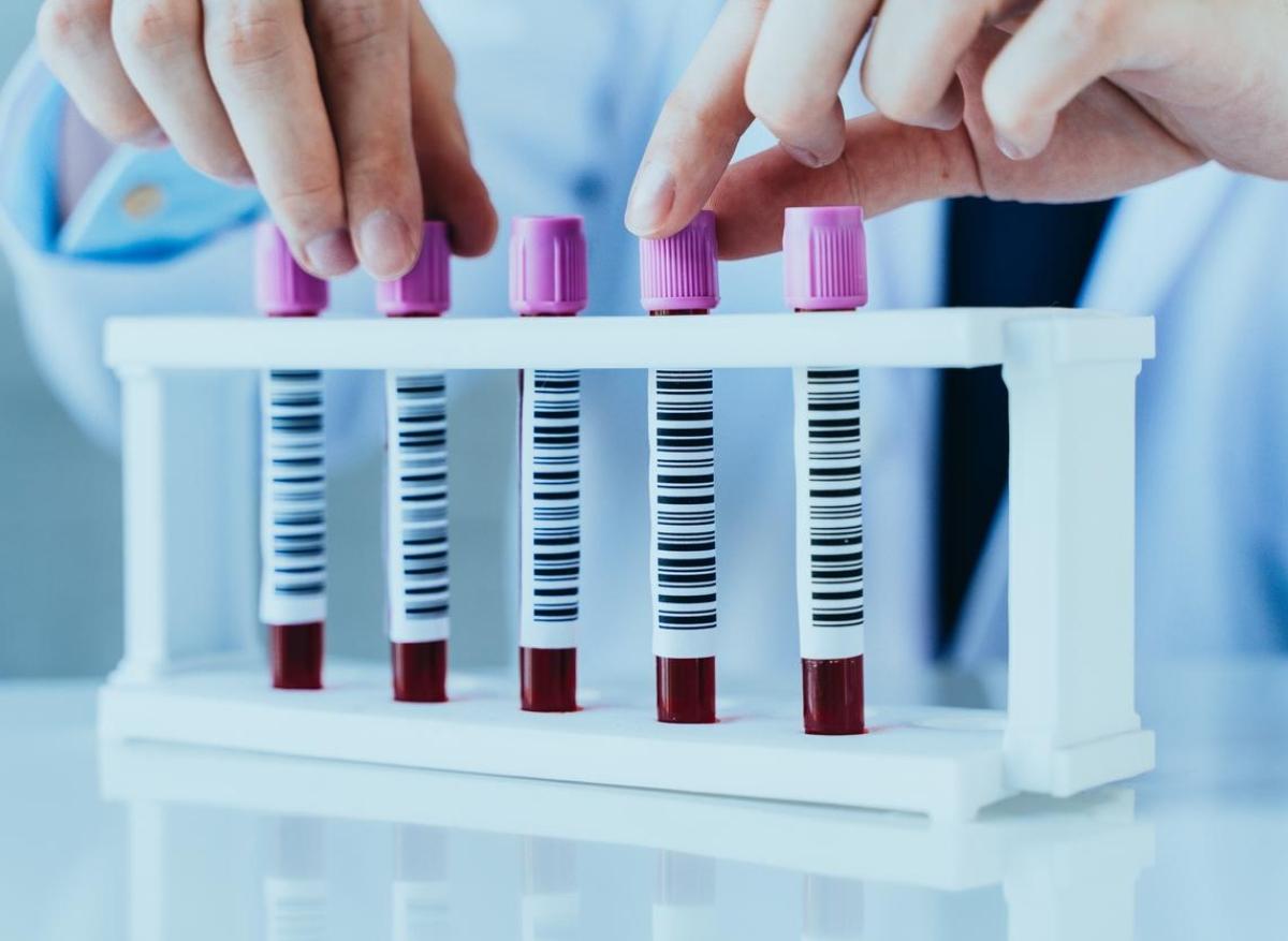 Trouble bipolaire : un test sanguin pour le diagnostiquer