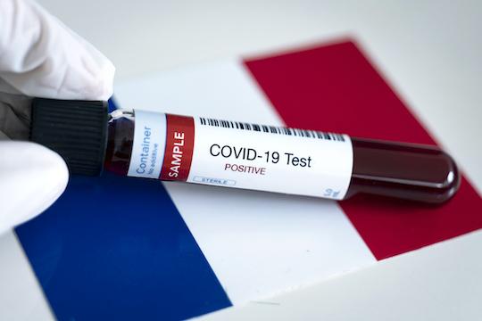 Covid-19 : les clés pour interpréter les tests PCR et sérologiques 