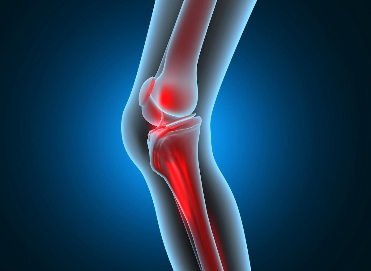 Arthrose : un hydrogel pour la réparation du cartilage en phase pré-clinique