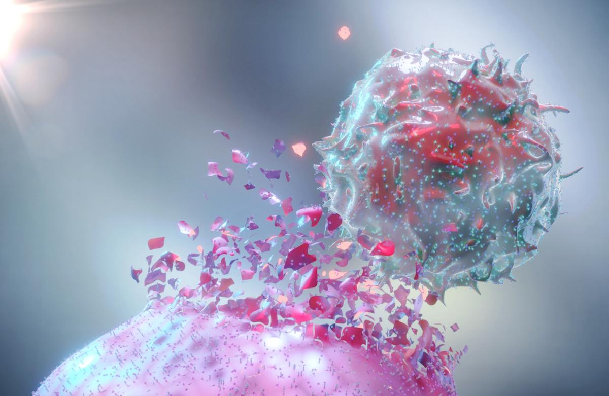 Cancers incurables : des lymphocytes T modifiés pour un traitement personnalisé