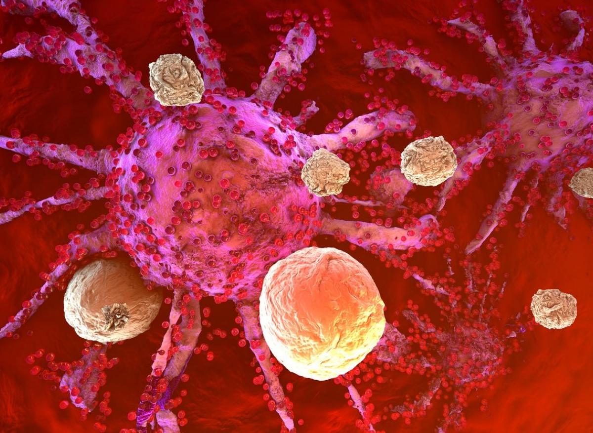 Cancer du col de l’utérus : l’immunothérapie prolonge la survie 