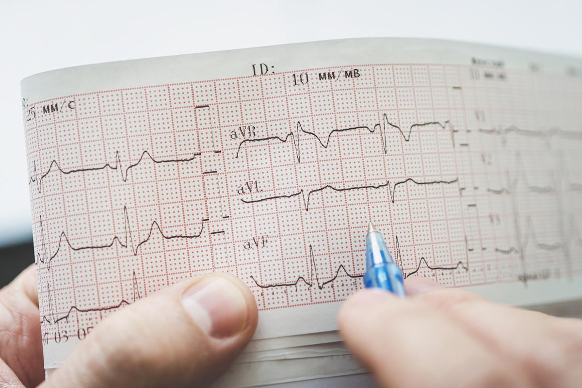 Covid-19 : moins d’arythmies cardiaques chez les femmes hospitalisées