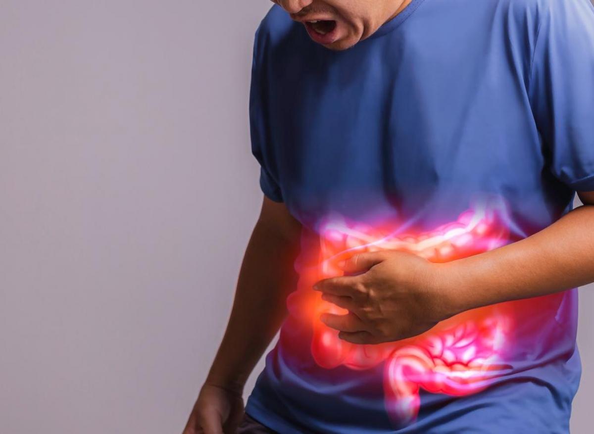 Côlon irritable : des biofilms bactériens dans l’intestin