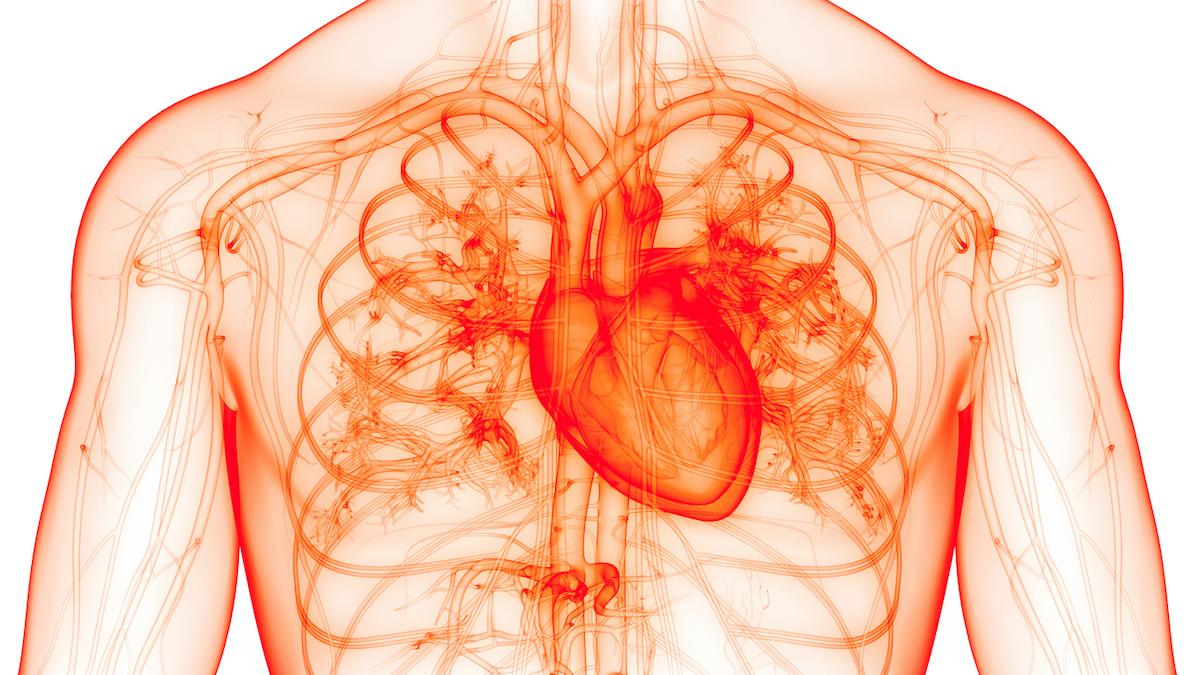 Angioplastie avec stent sous anticoagulants : le traitement est clarifié